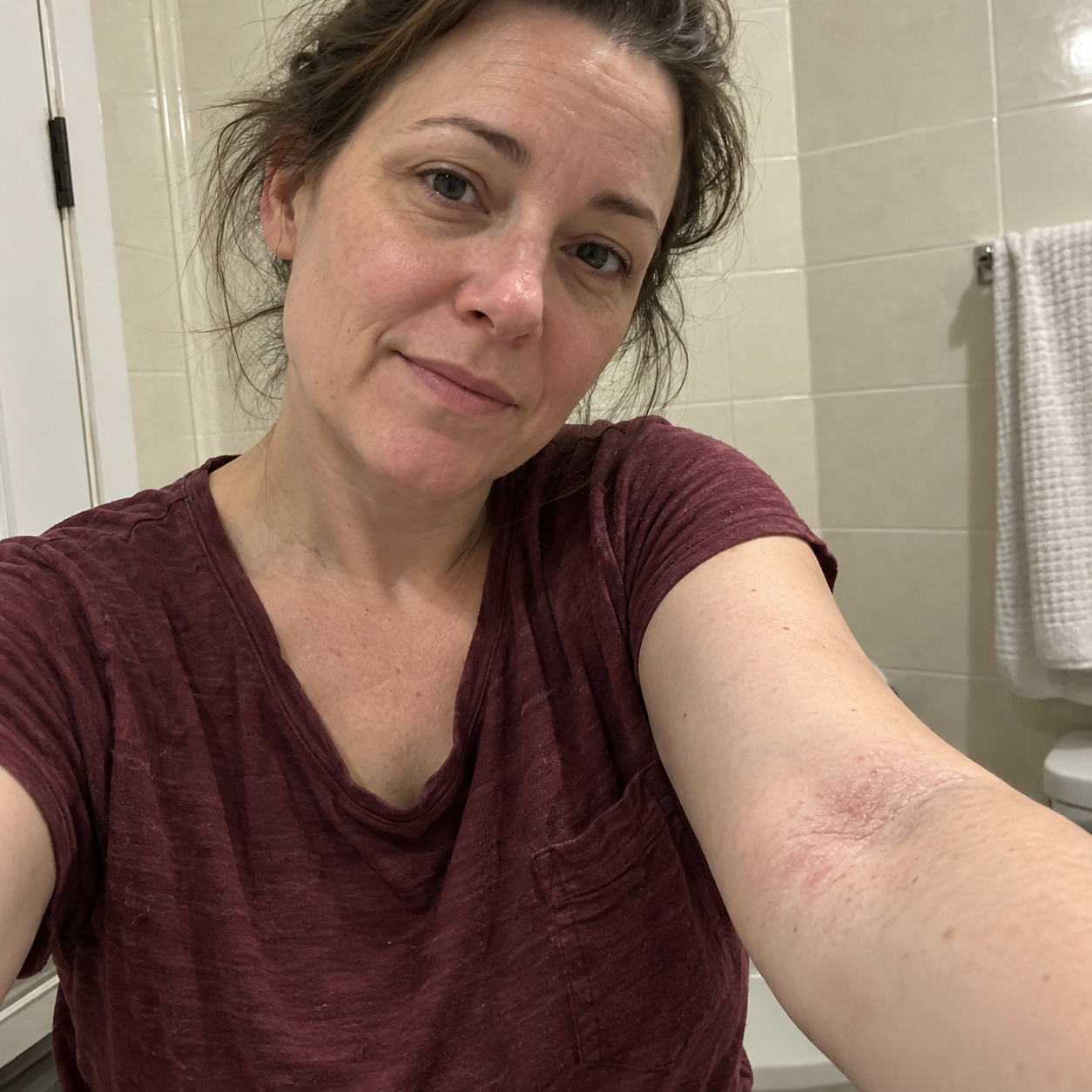 AI-generated bathroom selfie of a fictional woman in a burgundy shirt showing dry skin at her inner elbow; not a customer result